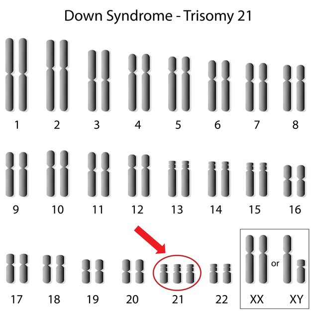 chromosom 21
